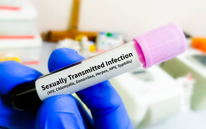 Sexually Transmitted Infections: Signs, Testing and Treatment