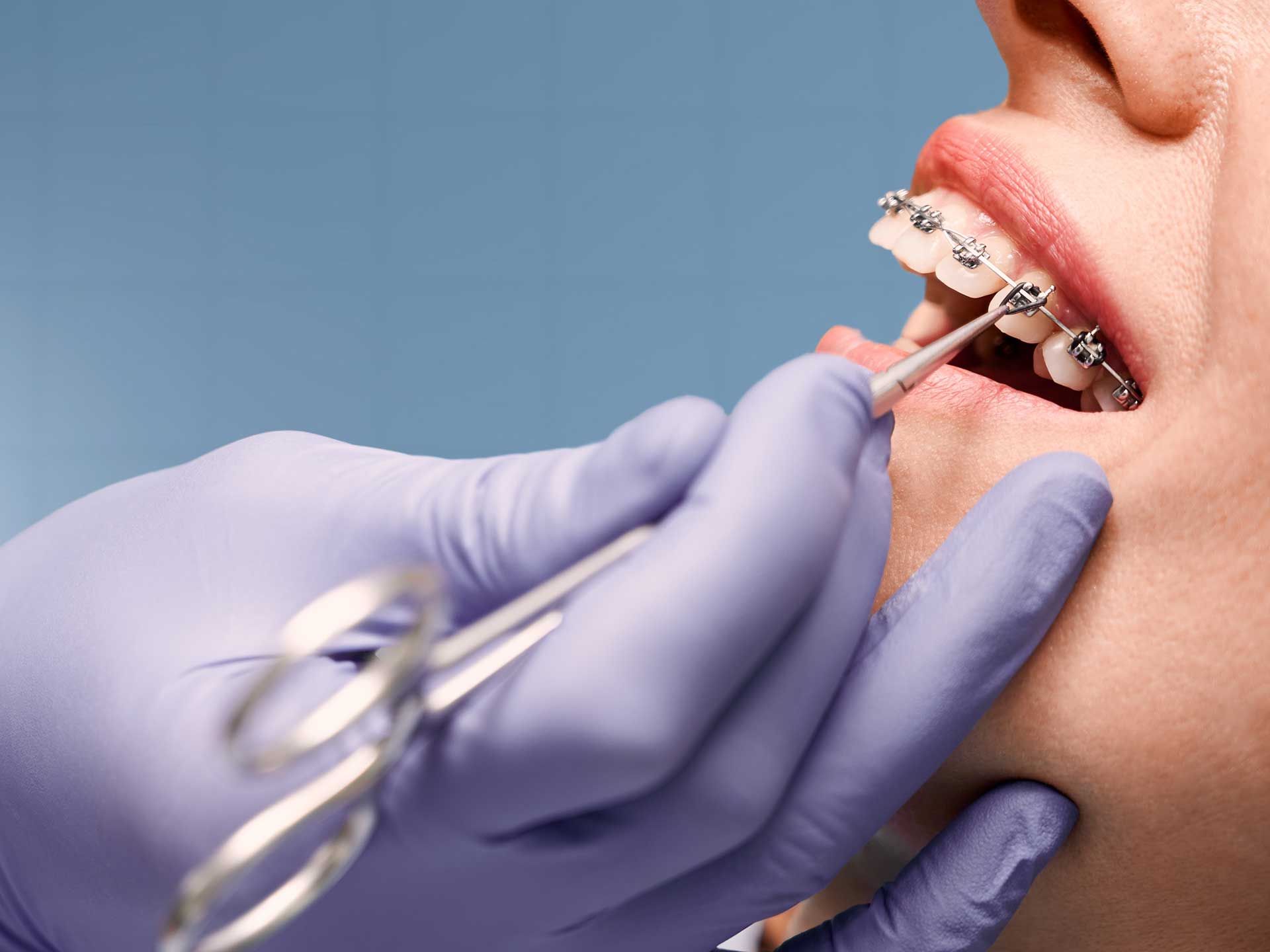 Family Dental Health: Building Good Habits for Life